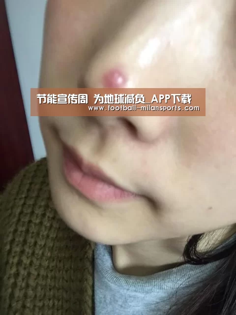 米兰体育